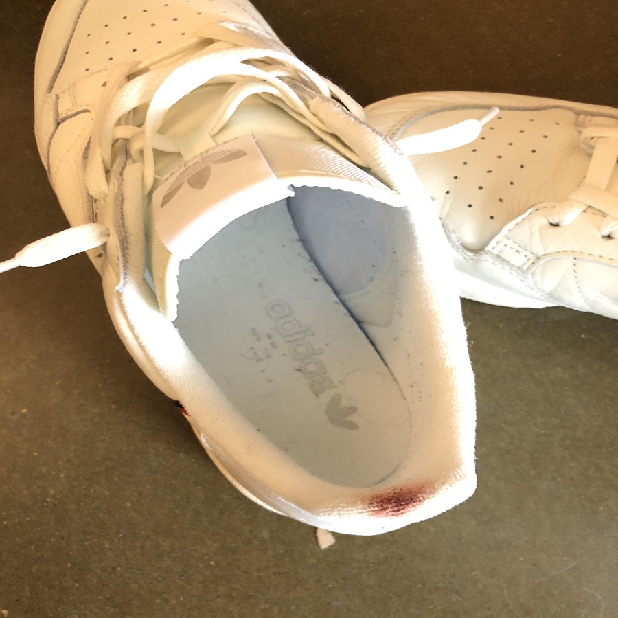 How to Remove Blood Stain from Shoes